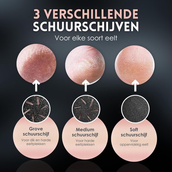 Beeperfect® Pince à callosités électrique avec système d'aspiration - Lime à pieds - Lime à callosités - Étanche IPX7 - Ensemble de pédicure gratuit - Comprend 6 disques à callosités - Noir