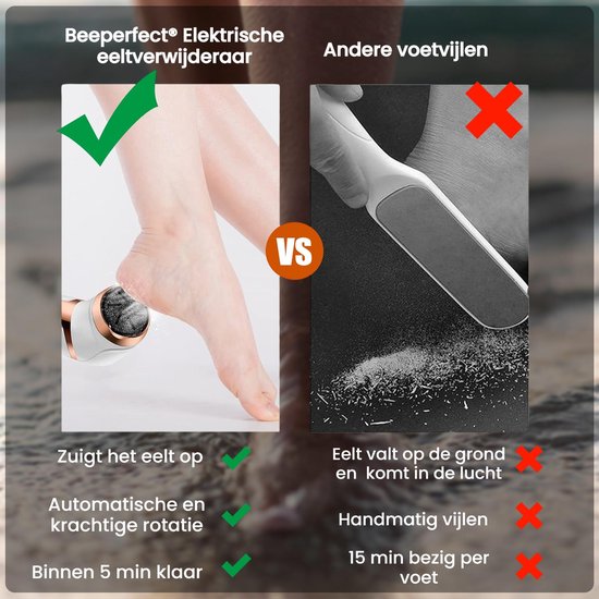 Beeperfect® Extracteur de callosités électrique avec système d'aspiration - Lime à pieds - Lime à callosités - Étanche IPX7 - Comprend 6 disques à callosités - Ensemble de pédicure gratuit