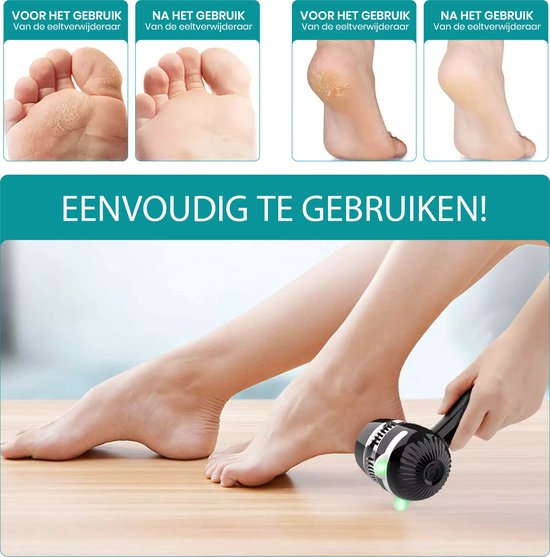 Appareil électrique Apeiron pour éliminer les callosités – Lime pour les pieds – Appareil professionnel pour éliminer les callosités – Lime à callosités – Appareils pour éliminer les callosités – Rechargeable par USB – 3 disques de limage supplémentaires