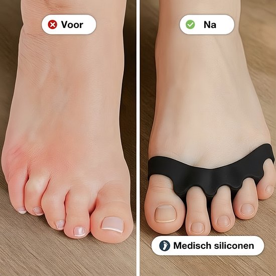 Alyze Toe Spread Silicon - 2 Pieces - Hallux Valgus Corrector - Toe Protector - Toe Spreaders - Toe Corrector - Hammer Toe Brace - Big Toe - Personal Care