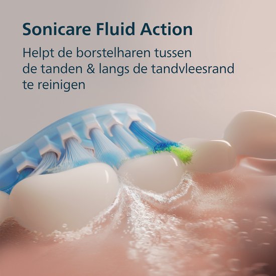 Philips Sonicare DiamondClean 9000 - Brosse à dents électrique - Rose/Blanc - Ombré - HX9911/84