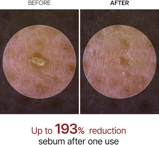 Dr. Melaxin - Peel Shot Exfoliant Ampoule au riz blanc - 80 ml