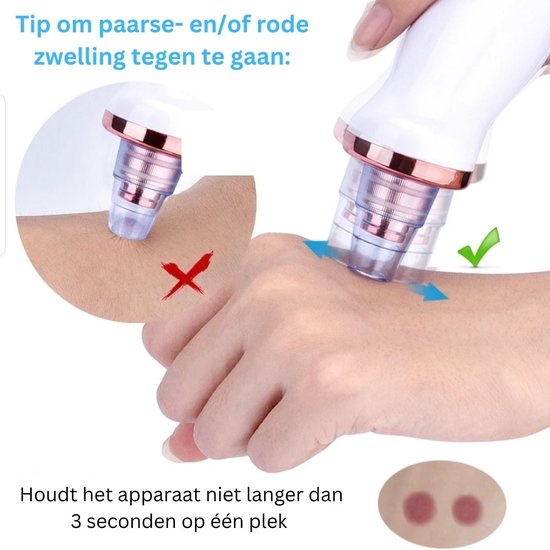 DAKANNA® - Élimination des points noirs - Élimination des points noirs - Élimination des points noirs - Soins du visage - Électrique - Acné - Aspirateur - Soins de la peau - Jeu d'outils multiples