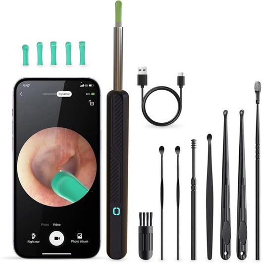 Alyze Earwax Remover with Camera - Nettoyeur d'oreilles électrique avec 6 accessoires et chargement USB-C