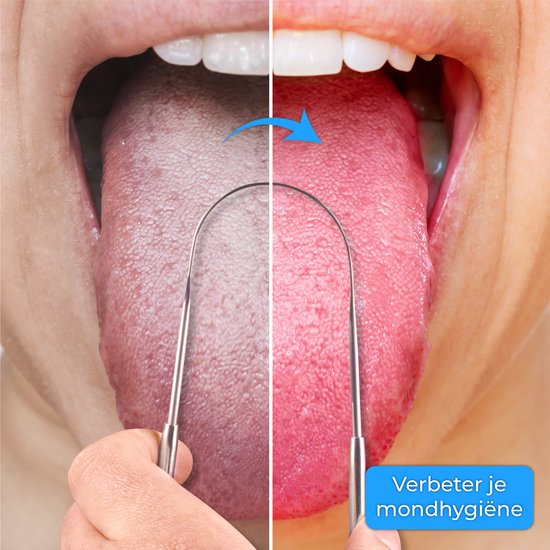 Nuvance - Gratte-langue professionnel - Set 3 en 1 - pour les soins bucco-dentaires - Nettoyeur de langue - Gratte-langue - gratte-langue - acier inoxydable