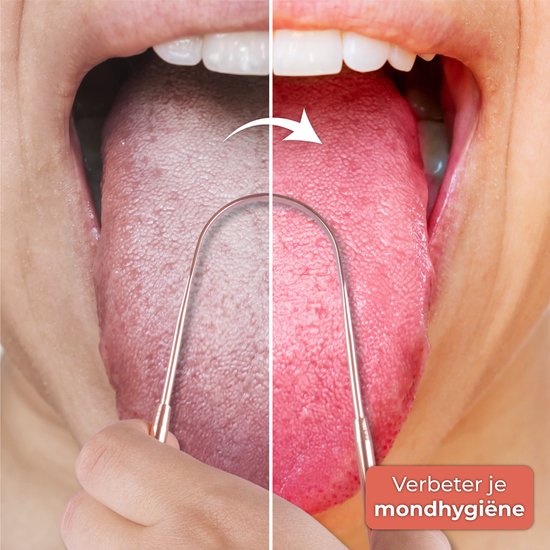 Nuvance - Gratte-langue professionnel - Set 3 en 1 - pour les soins bucco-dentaires - Nettoyeur de langue