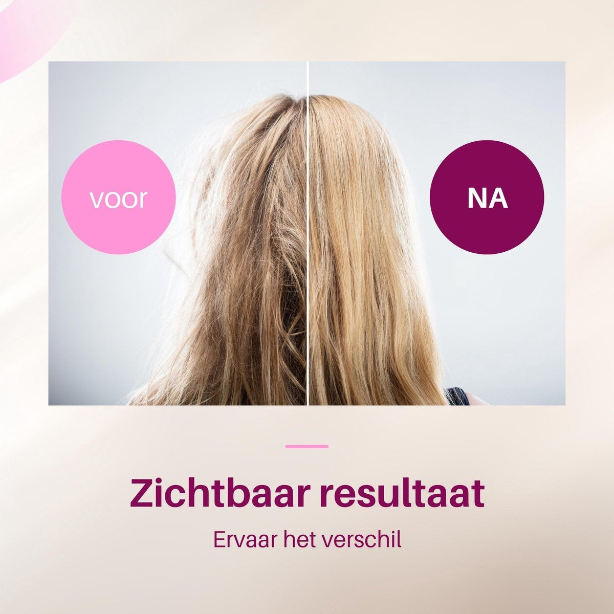 Fineza - Set de brosses pour sèche-cheveux - Noir/Rose