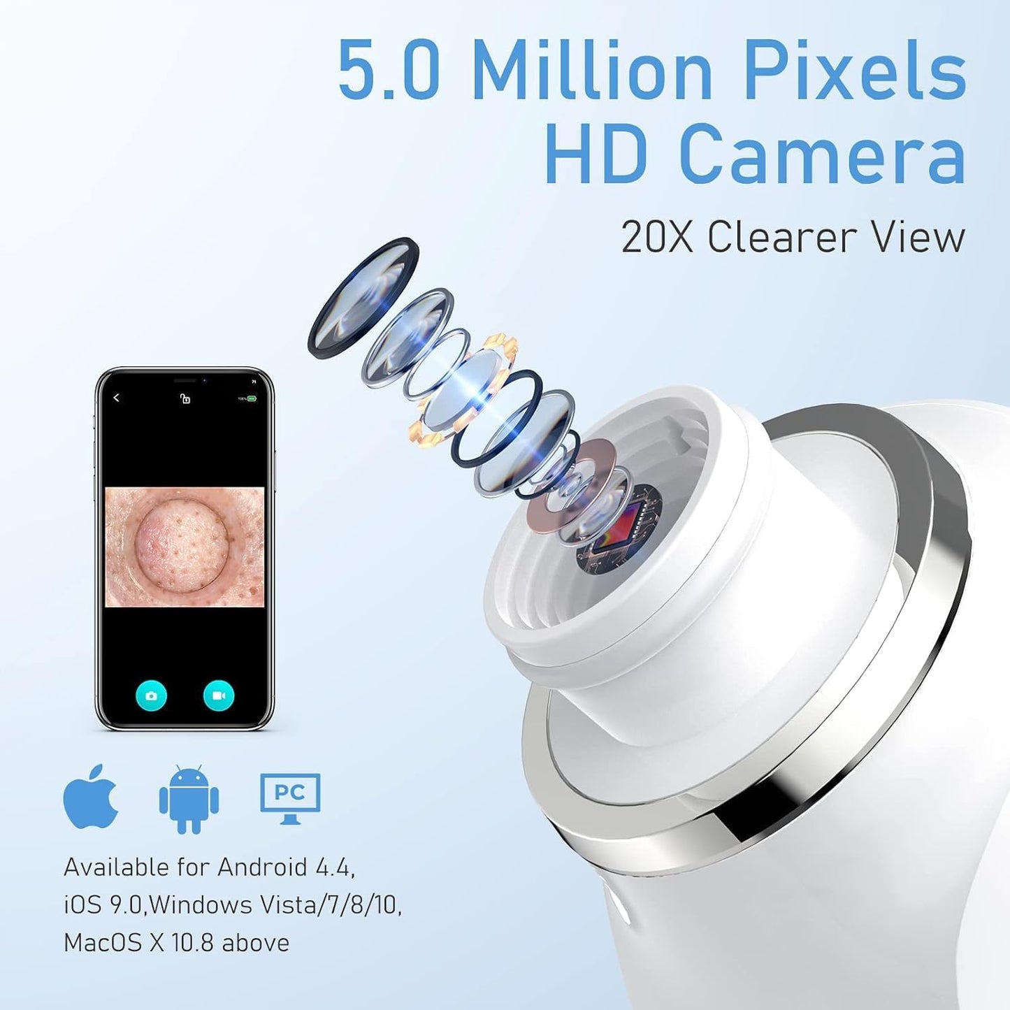 Ottleba Aspirateur de points noirs avec caméra HD 1080P - 17 × 4,5 × 4,5 cm - Rose pâle - Nettoyeur de pores avec 3 niveaux d'aspiration et 6 accessoires