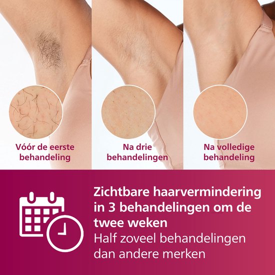 Philips Lumea série IPL 7000 - Appareil d'épilation IPL - 2 têtes avec tondeuse - BRI921/00