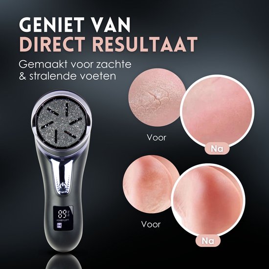 Beeperfect® Pince à callosités électrique avec système d'aspiration - Lime à pieds - Lime à callosités - Étanche IPX7 - Ensemble de pédicure gratuit - Comprend 6 disques à callosités - Noir
