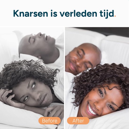 Orthèse de nuit - Mors pour dents droites - Mors pour adultes - Mors - Meulage des dents