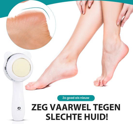 Appareil électrique Apeiron pour éliminer les callosités – Lime pour les pieds – Appareil professionnel pour éliminer les callosités – Lime à callosités – Appareils pour éliminer les callosités – Rechargeable par USB – 3 disques de limage supplémentaires