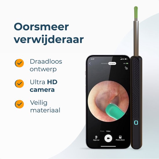 Alyze Earwax Remover with Camera - Nettoyeur d'oreilles électrique avec 6 accessoires et chargement USB-C