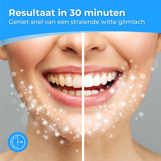 Nuvance - Bandes de blanchiment des dents - Set de blanchiment des dents - blanchiment des dents - avec 0% de peroxyde - dents blanches - 14 sets/28 bandes