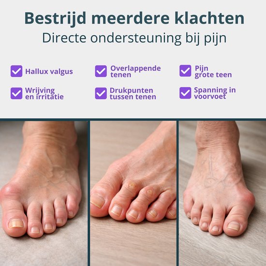 VeryGoods™ Hallux Valgus Toe Corrector - Toe Spreader Big toe - 2 Pieces - Toe protector - Hammer toe - Toe spreaders