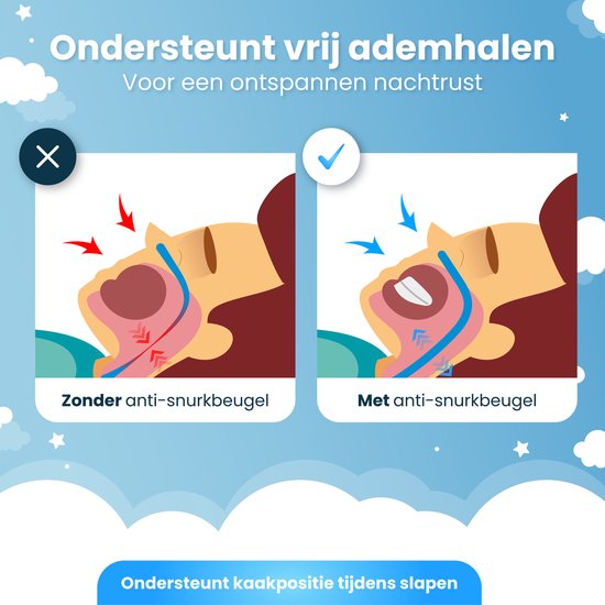 DreamCare Anti Snore Brace - Anti ronflement - Attelle anti ronflement - Ajustable - Attelle anti ronflement - Produits anti ronflement - Sans Bpa
