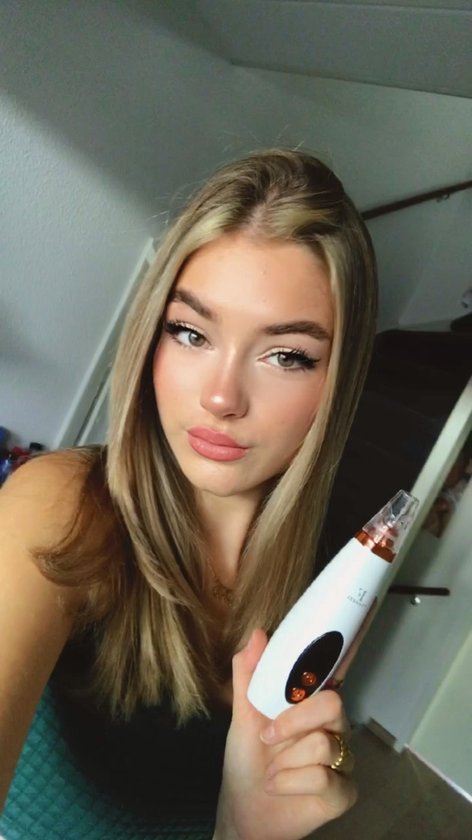 TibaGoods Premium Blackhead Remover I Pore Cleaner with 6 Attachments Remove blackheads | Acne | Comedone Spoons | Skin Care