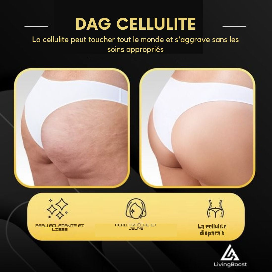 Appareil de massage électrique contre la cellulite LivingBoost®- Gua Sha inclus - 12 niveaux et températures - Corps entier - Massage par ventouses - Anti cellulite - noir
