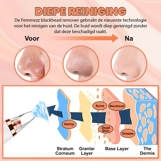 TibaGoods Premium Blackhead Remover I Pore Cleaner with 6 Attachments Remove blackheads | Acne | Comedone Spoons | Skin Care