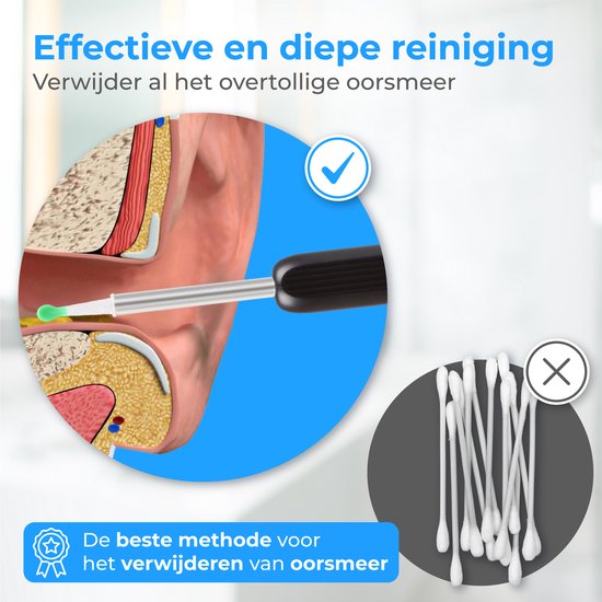 Nuvance - Extracteur de cérumen avec application caméra - Nettoyeur d'oreilles - Set de nettoyage d'oreilles - Pulvérisateur d'oreilles - Earscratcher - Set de nettoyage inclus