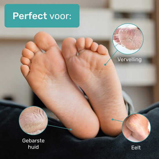 Chaussettes à callosités douces et soyeuses - 2 packs - Masque d'exfoliation des pieds - Élimination des callosités pour les pieds - Masque pour les pieds - Callosités - Lime - Râpe - Crème de remplacement - Élimination - Lavande -...