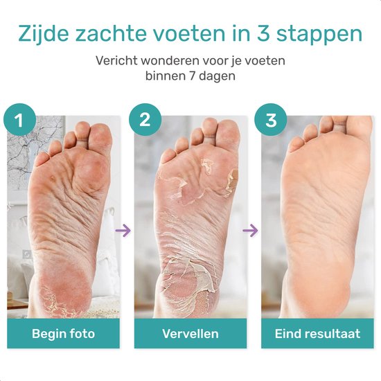 Chaussettes à callosités douces et soyeuses - 2 packs - Masque d'exfoliation des pieds - Élimination des callosités pour les pieds - Masque pour les pieds - Callosités - Lime - Râpe - Crème de remplacement - Élimination - Lavande -...