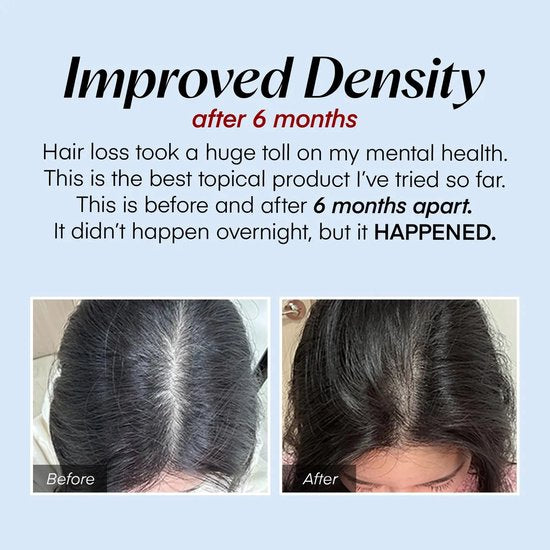 Seapuri Scalpy Hair Serum [Korean Hair Care] [20ml]