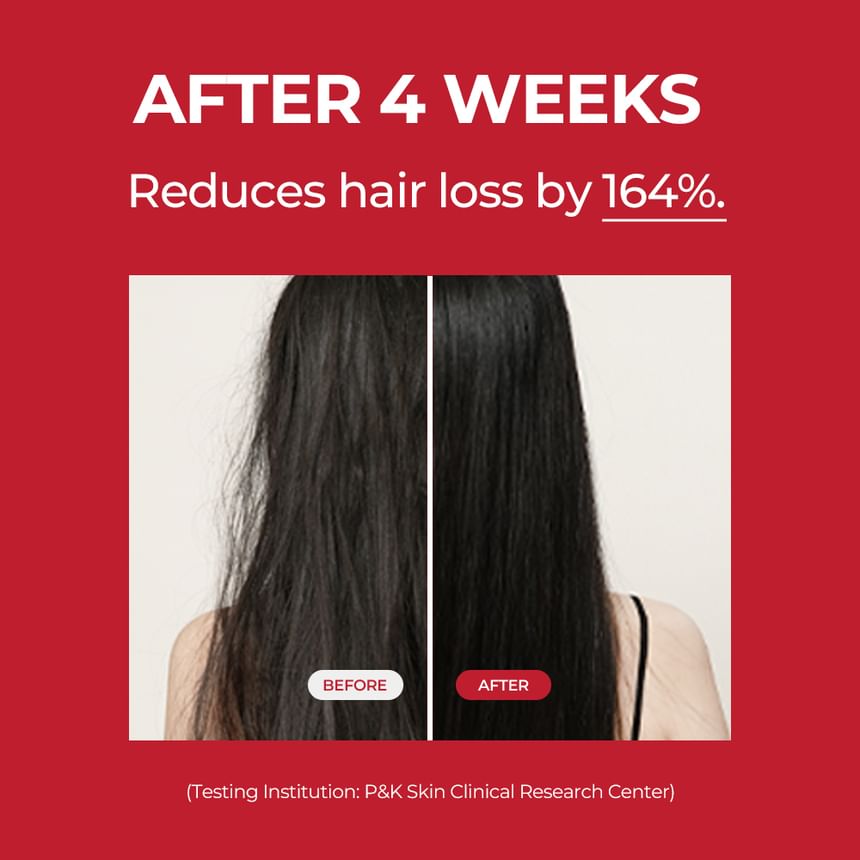 MOEV Annurcatin Hair Tonic 150ml - Hydrate et renforce les cheveux - Fragrance de pomme fraîche