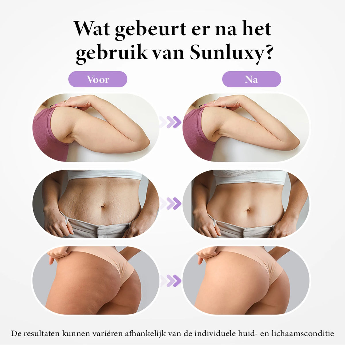 Appareil de massage anti-cellulite Sunluxy BCE1 - EMS + vide + lumière rouge - 3 modes pour le corps et le visage - rechargeable - 19,4 x 17 x 7,8 cm