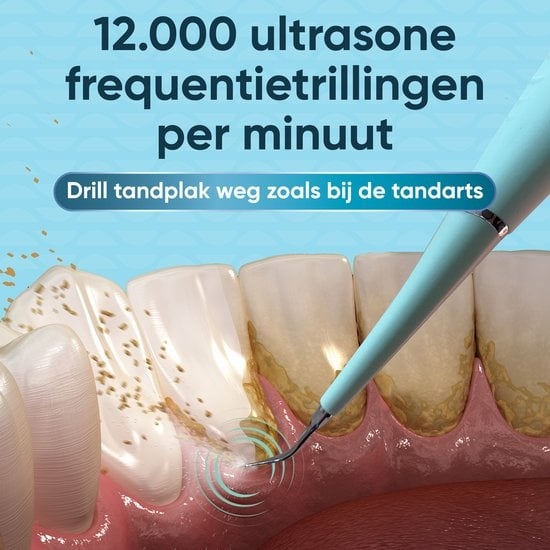 Détartreur électrique - Polissage des dents - Détartreur dentaire - Détartreur électrique