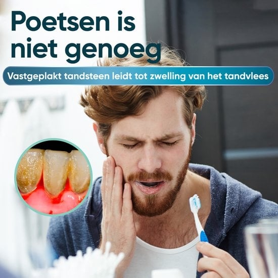 Détartreur électrique - Polissage des dents - Détartreur dentaire - Détartreur électrique