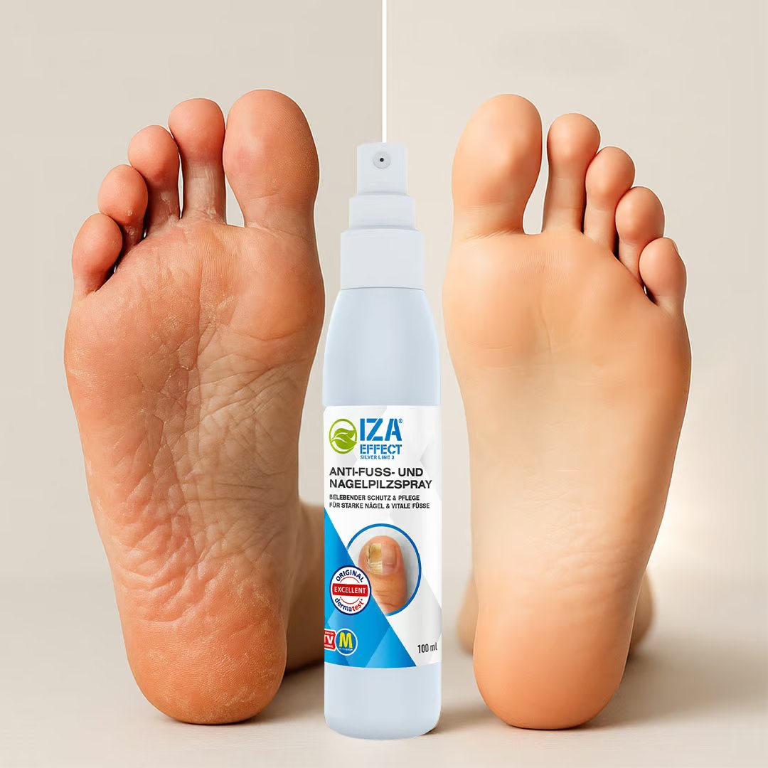 Kit de sprays IZA Effect contre les mycoses des pieds et des ongles - Application rapide - Résultats visibles - 1 + 1 gratuit