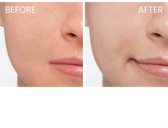 ISDIN - Fotoultra Spot Prevent - SPF50+ - 50 ml - Prévient l'apparition des taches cutanées