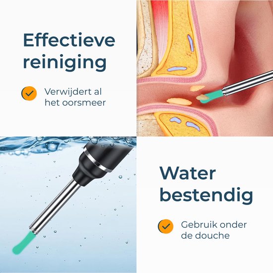 Alyze Earwax Remover with Camera - Nettoyeur d'oreilles électrique avec 6 accessoires et chargement USB-C