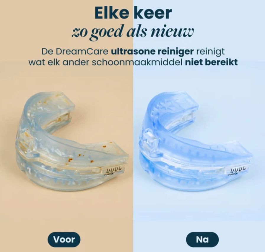 DreamCare UltraPod - Nettoyeur à ultrasons - Blanc - 5 modes de fonctionnement, nettoie en 60 secondes