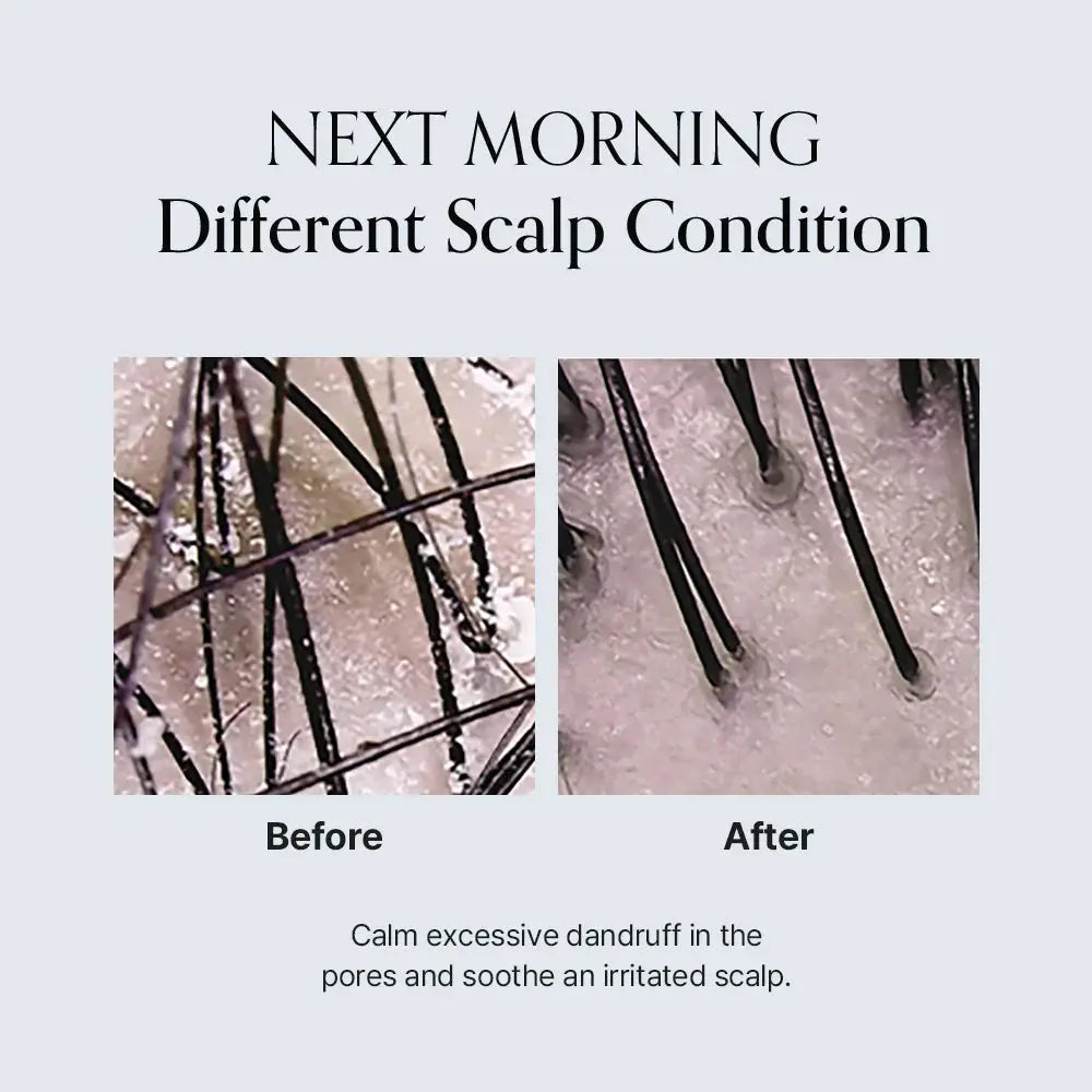 GROWUS Damage Therapy Scalp Scaling Ampoule - Réinitialisation intensive du cuir chevelu